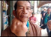 Tumor Ganas Gerogoti Leher Pria Sukabumi, Butuh Uluran Tangan untuk Operasi
