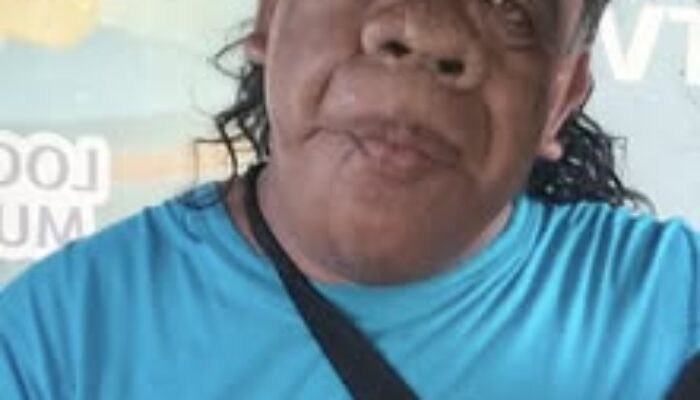 Dulu Disebut Anak Genderuwo Kehidupan Sosok Wagini Kini Justru Tenar dan Tuai Simpati