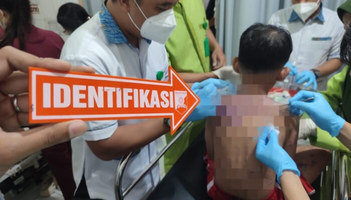 Ibu dan Anak di Sukabumi Jadi Korban Penyiraman Air Keras, Polisi Buru Pelaku
