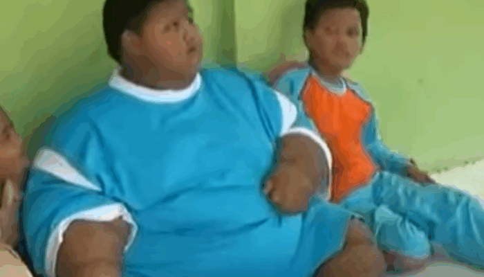 Masih Ingat  Arya Permana Si Bocah Berbobot 192 Kilogram? Ini Kabarnya Sekarang