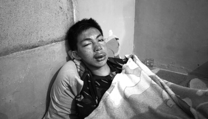 Remaja di Sukabumi Nyaris Tewas Diduga Salah Tangkap, Keluarga Tolak Damai dan Ungkap Fakta Mengejutkan