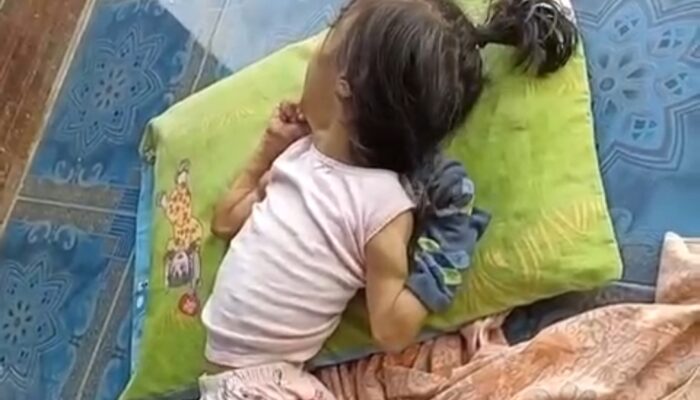 Anak 8 Tahun di Sukabumi Terbaring Sakit, Keluarga Keluhkan Tak Ada Perhatian Pemerintah