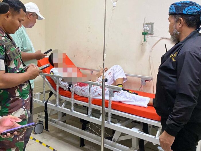 Seorang pelajar SMK menjadi korban pembacokan oleh orang tak dikenal saat hendak berangkat ke sekolah, di Kecamatan Cibadak, Kabupaten Sukabumi, Senin pagi (20/10/2025).