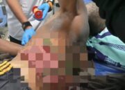 Tragis, Usus Lansia di Surade Sukabumi Keluar Usai Tertusuk Bambu