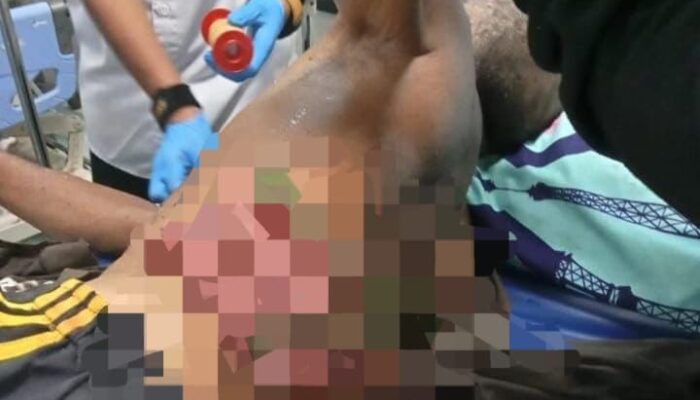 Tragis, Usus Lansia di Surade Sukabumi Keluar Usai Tertusuk Bambu