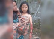 Viral Bocah Perempuan Luka Parah jadi Korban Begal HP di Sukaraja Sukabumi
