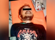 Polisi: Begal Apes di Cikembar Sukabumi Masih Jalani Perawatan