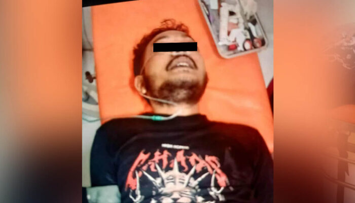 Polisi: Begal Apes di Cikembar Sukabumi Masih Jalani Perawatan