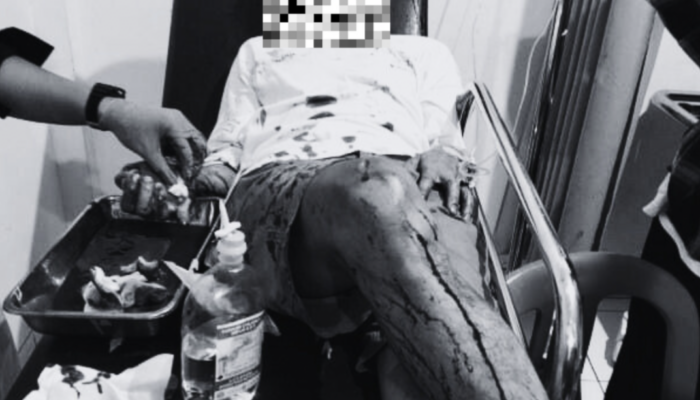 Tragedi Berdarah di Malam Tahun Baru! Empat Remaja Dibacok Brutal di Sekitar GO Balai Kota Sukabumi