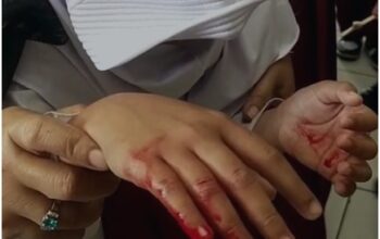 Wadah MBG Diduga Tajam, Siswa di Sukaraja Sukabumi Terluka