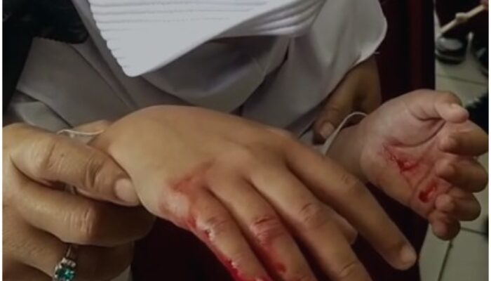 Wadah MBG Diduga Tajam, Siswa di Sukaraja Sukabumi Terluka