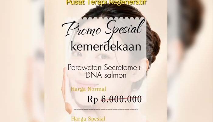 Promo Kemerdekaan, Pusat Terapi Regeneratif RSUD R. Syamsudin Tawarkan Perawatan Wajah Rp4,8 Juta